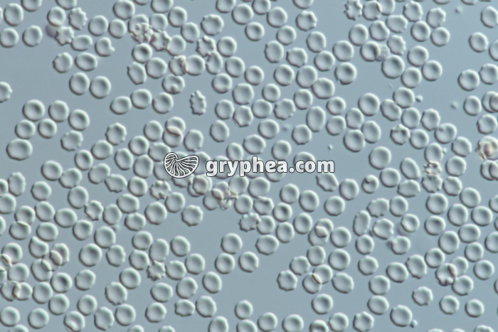 Hématies en milieu isotonique (sang humain) x160 - gryphea.org